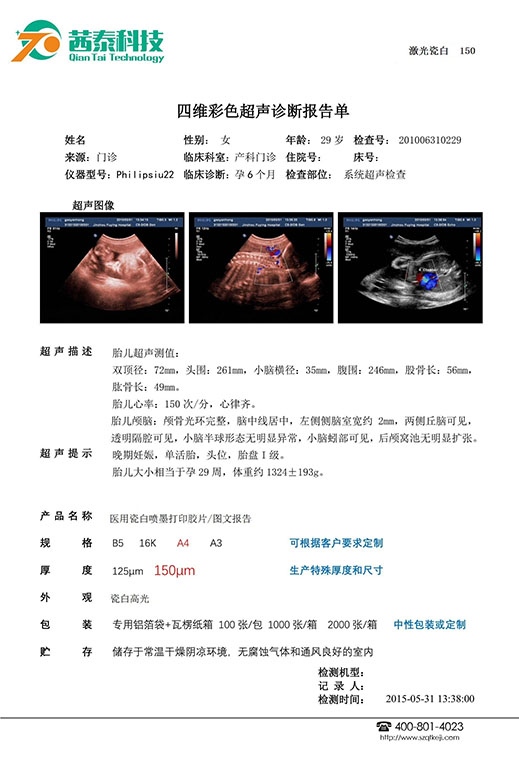 医用超声胶片