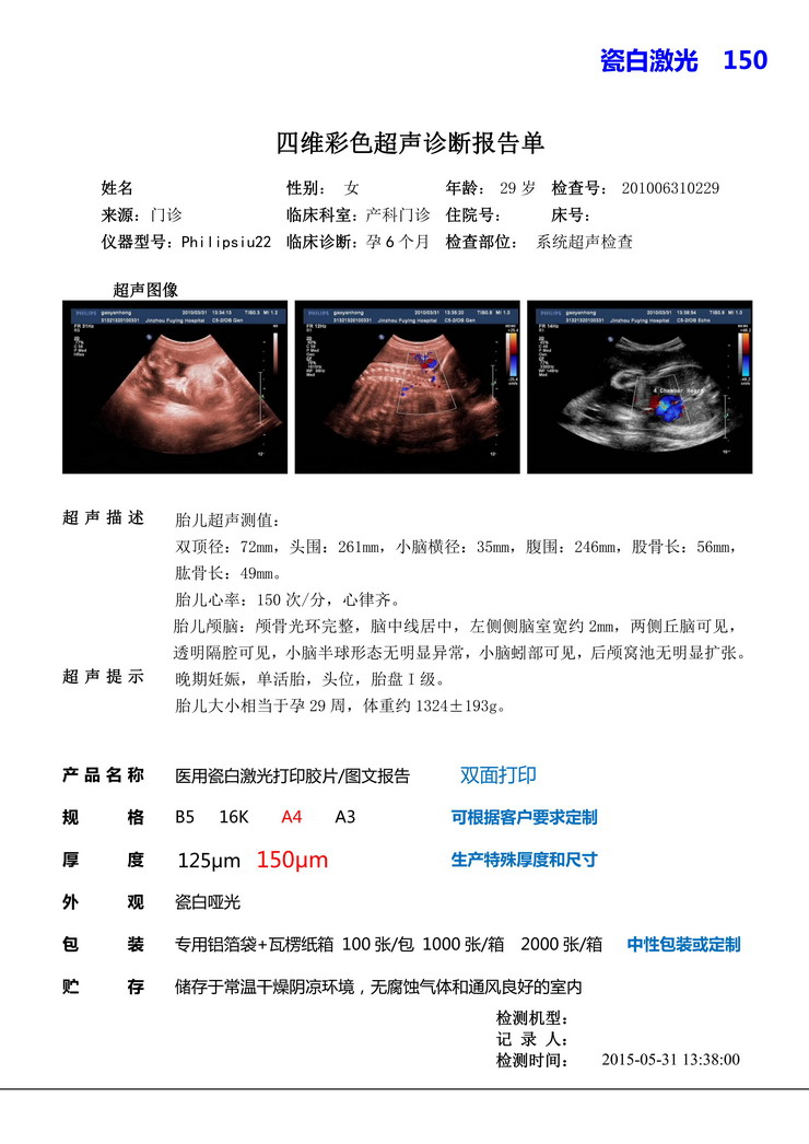 医用打印胶片