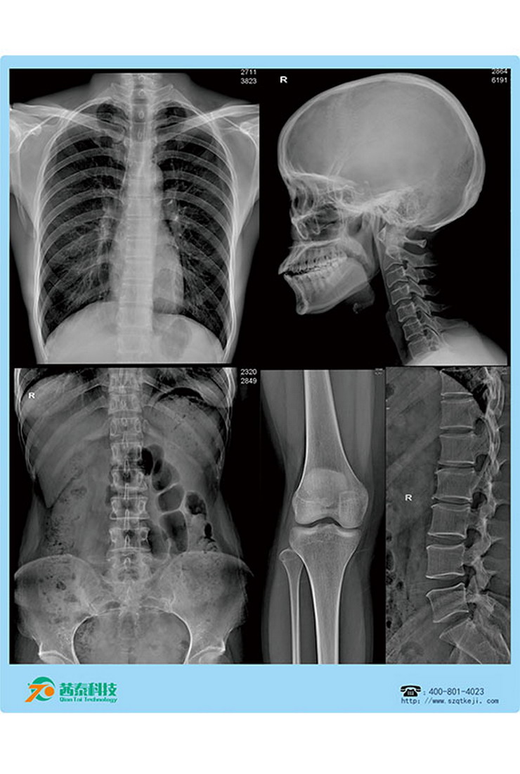 医用激光胶片-DR骨头四合一.jpg