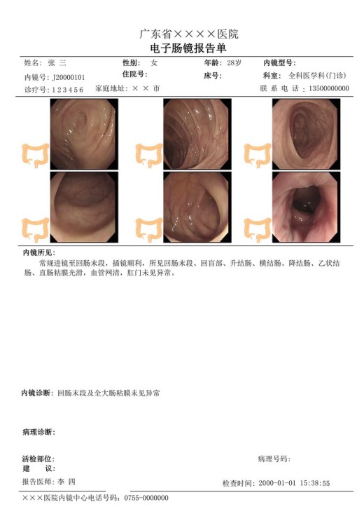 医用打硬胶片2.jpg